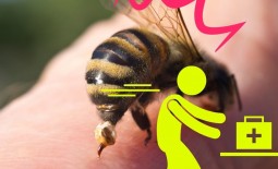 Укус такого насекомого, как пчела – стоит ли бояться и как помочь дома